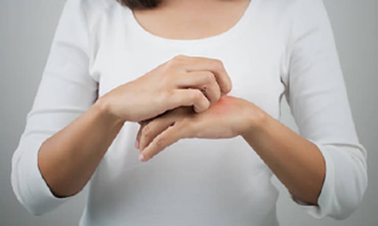 Colestasis intrahepática del embarazo