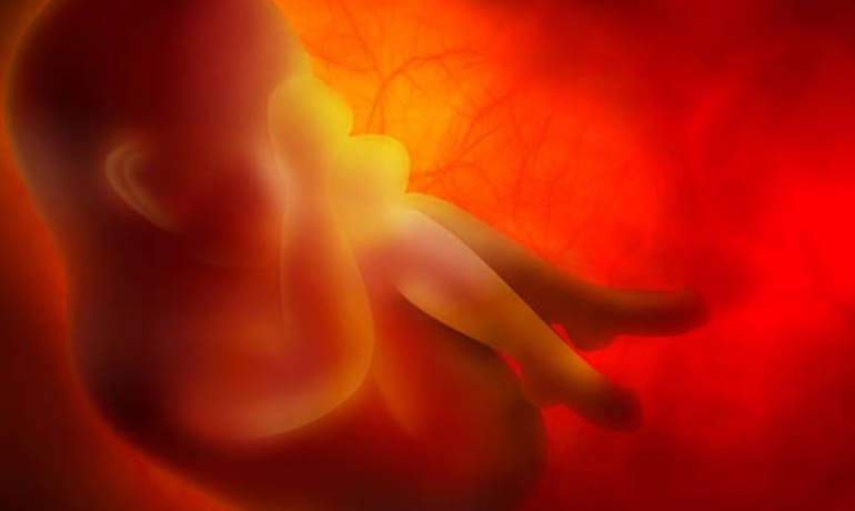 Alteraciones en líquido amniótico