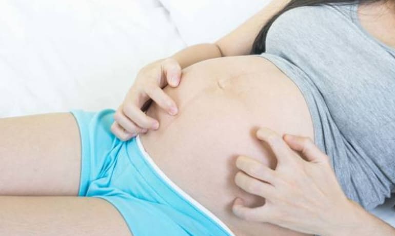 Dermatosis de la gestación