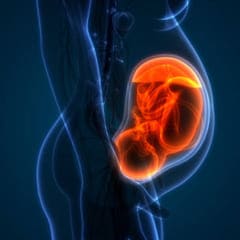 Alteraciones en líquido amniótico