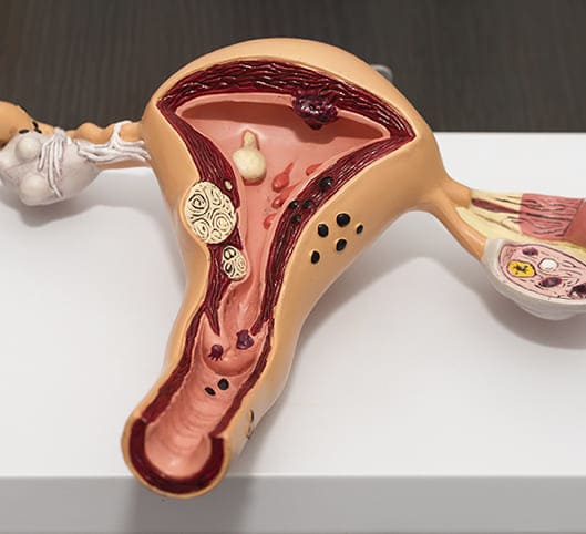 preguntas Ginecologia Chapultepec