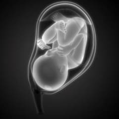 Ruptura prematura de las membranas